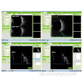 Tragbarer ophthalmischer A / B-Scanner